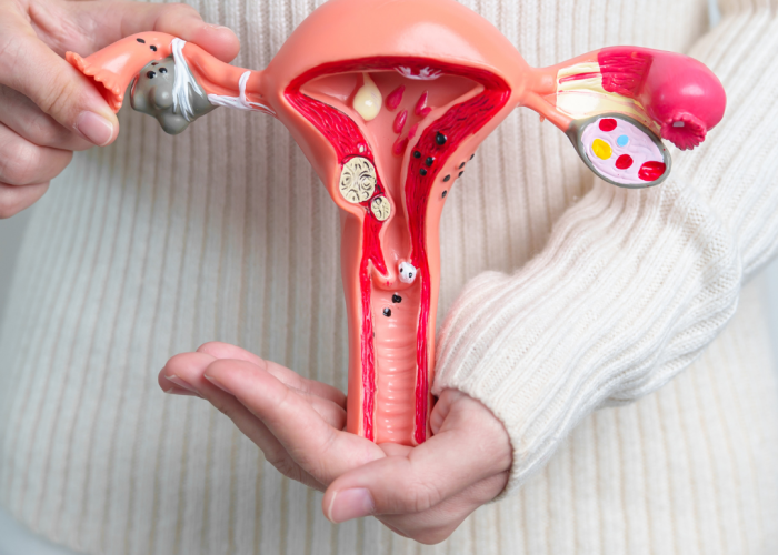 Dzemdes kakla vēzis